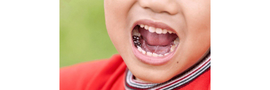 Детские металлические коронки