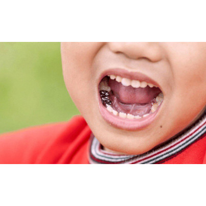 Детские металлические коронки